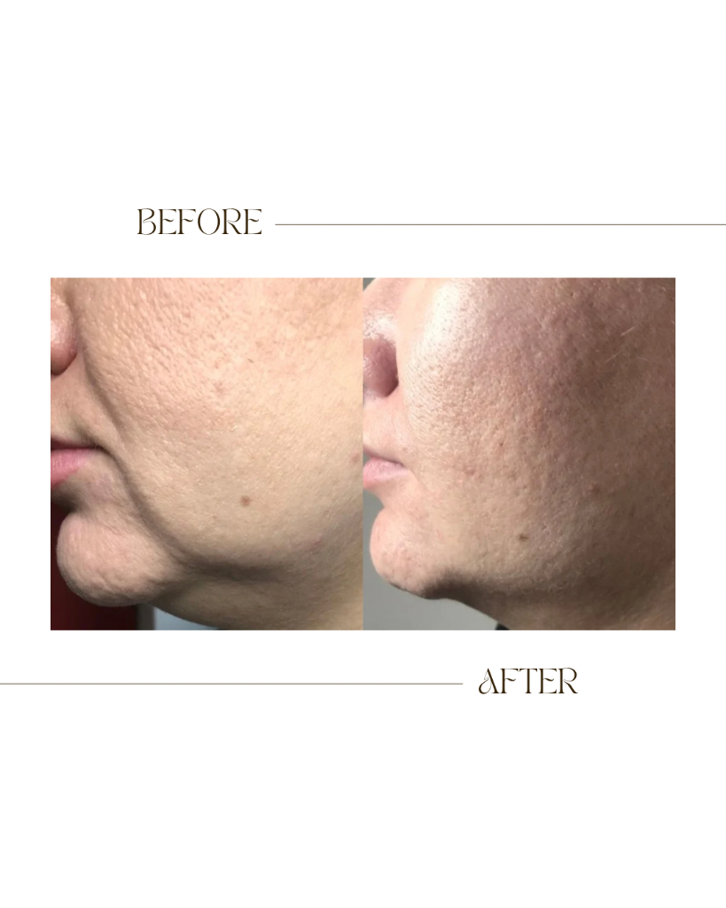 Face + Neck