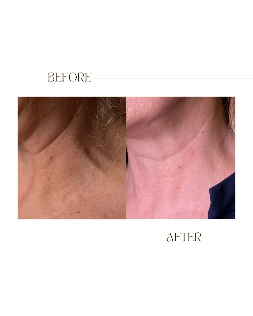 Neck