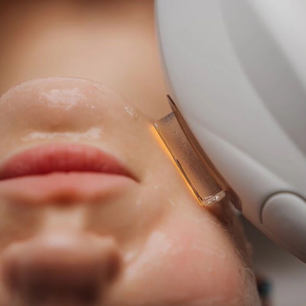 Skin rejuvenation