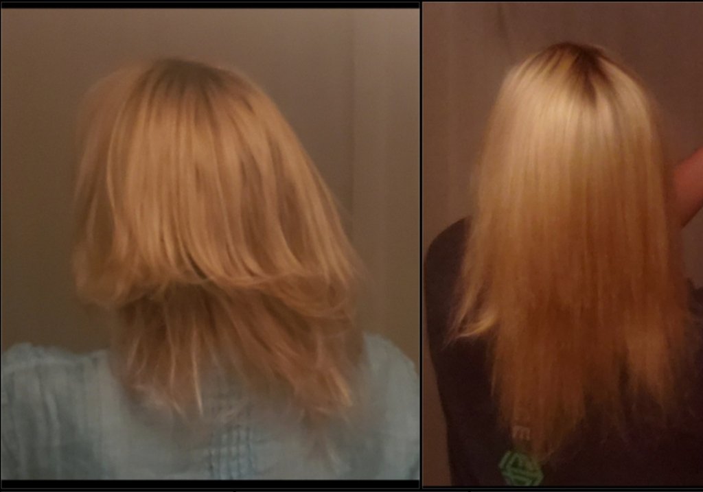 Hair growth progress