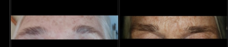 Brows transformation