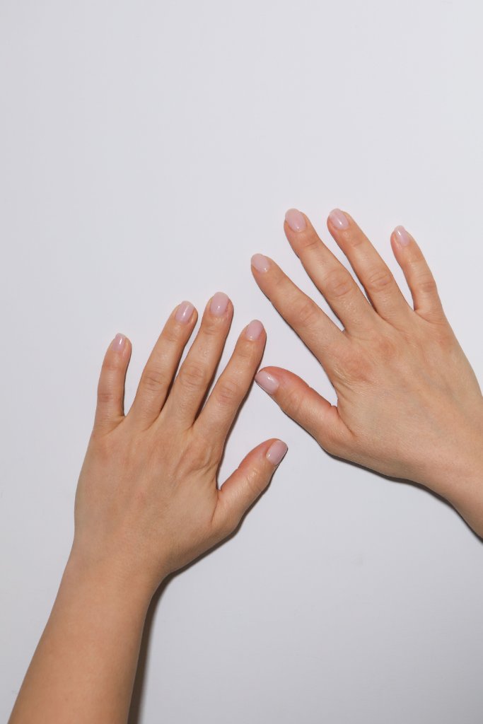Lipofilling delle Mani Napoli - Centro Maresca Corsaro