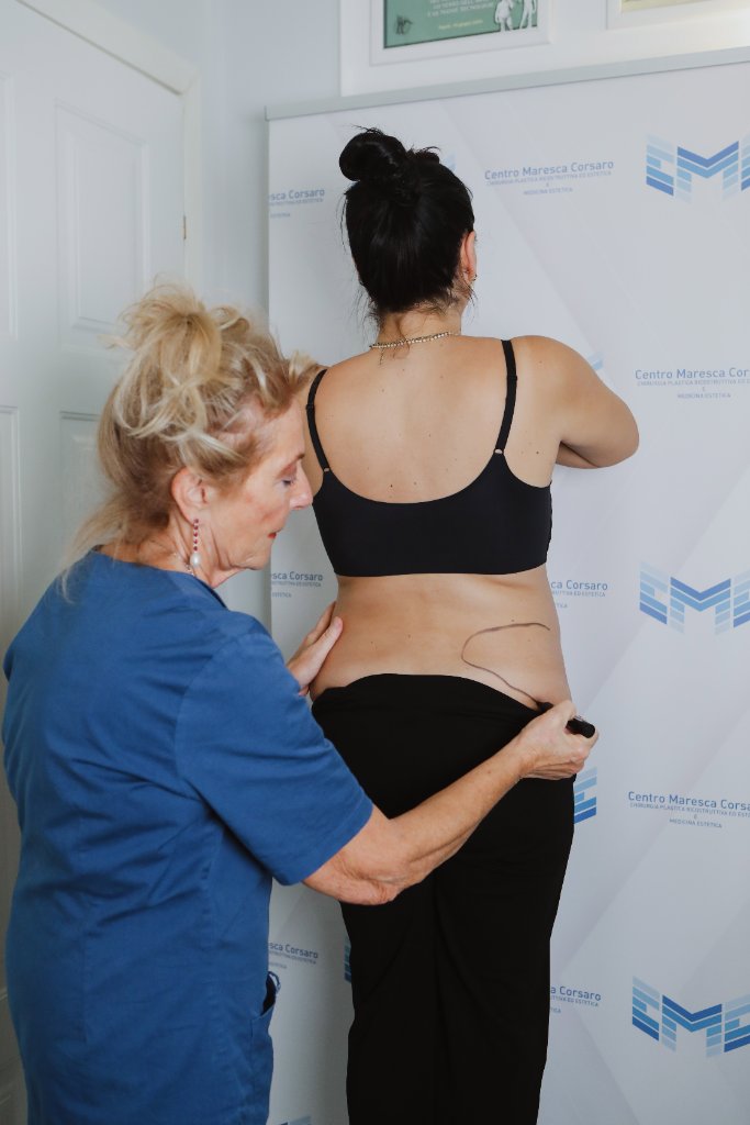 Mommy Makeover Napoli - Centro Maresca Corsaro