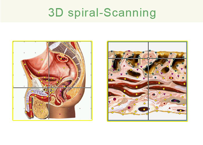 3D Spiral Scanning