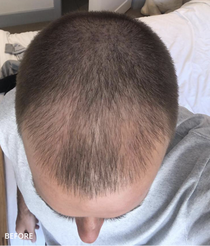 Before treatment