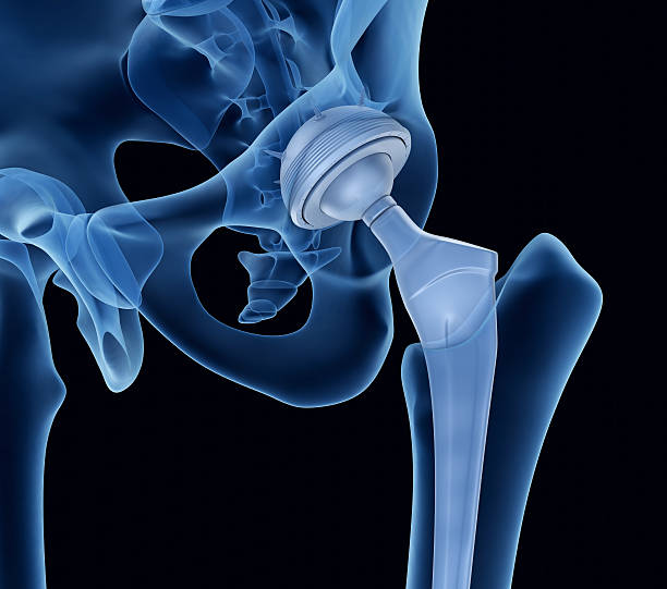 Medical Device Manufacturing