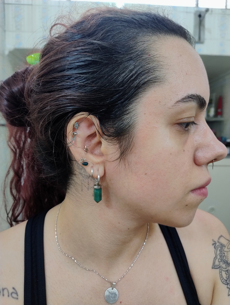 Depois do tratamento