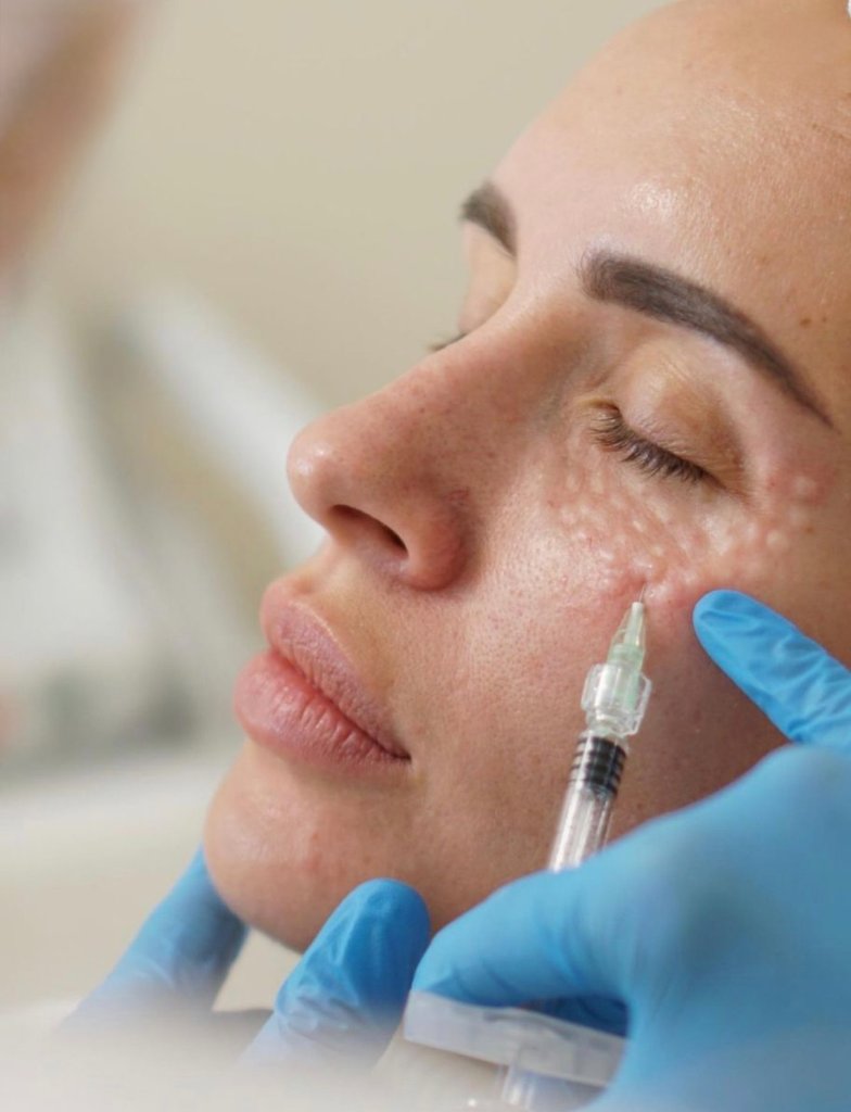 Skin Booster Injection