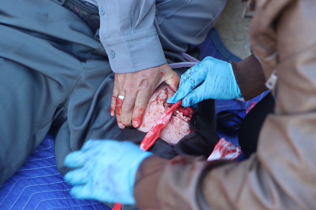 Hands-on wound care treatment training