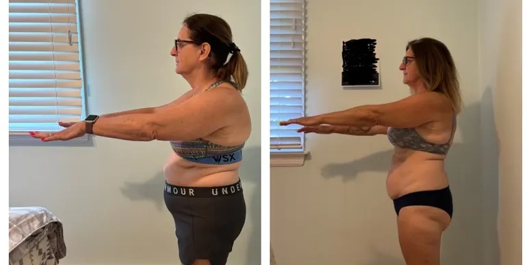 Transformation