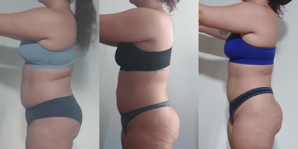 Transformation