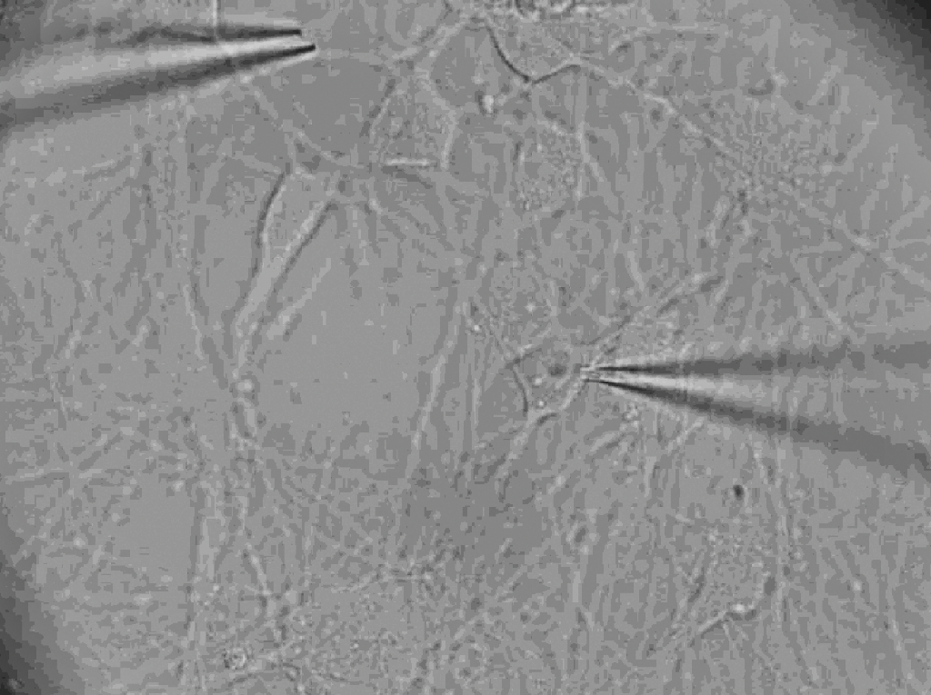 Human neuronal systems and disease