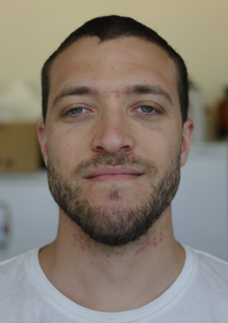 Martin Baccino