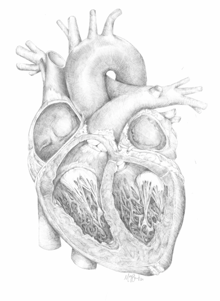 Tetralogy of Fallot