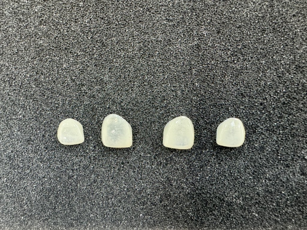 Case 9 · After