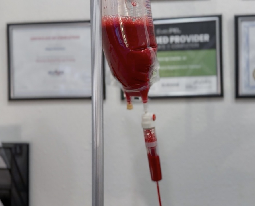 IV Ozone Therapy