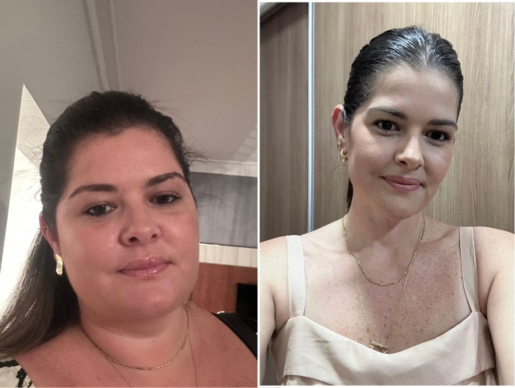 Transformação 3