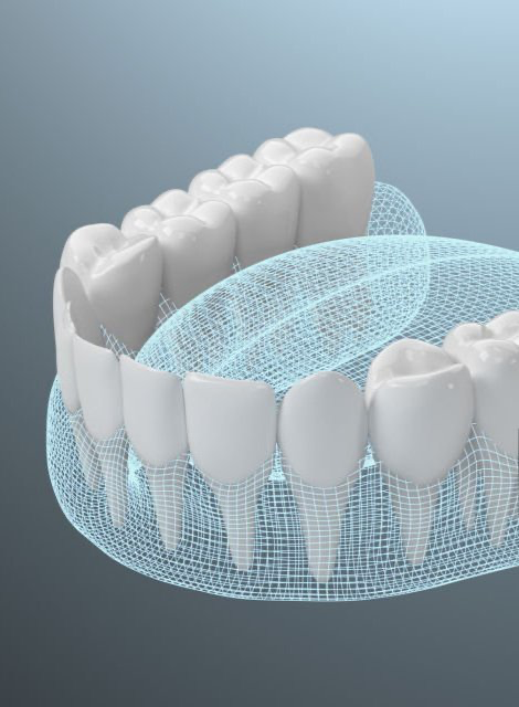 3D Zahnmodell