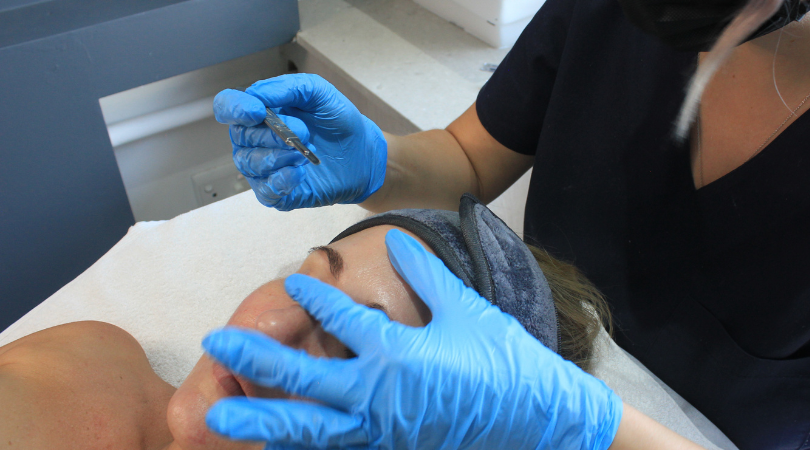 Dermaplaning