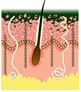 Blood flow and stimulating Langerhern cells