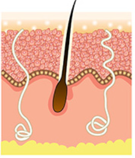 Collagen stimulation process
