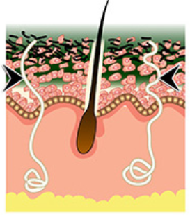 Algae microfibers absorbed