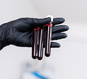 Blood Testing
