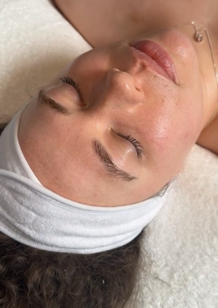 HydroFacial treatment