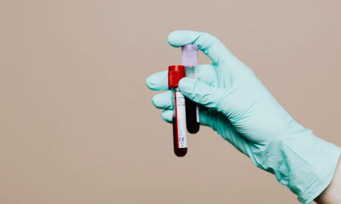 Blood Testing