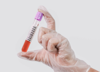 Skin Blood Testing