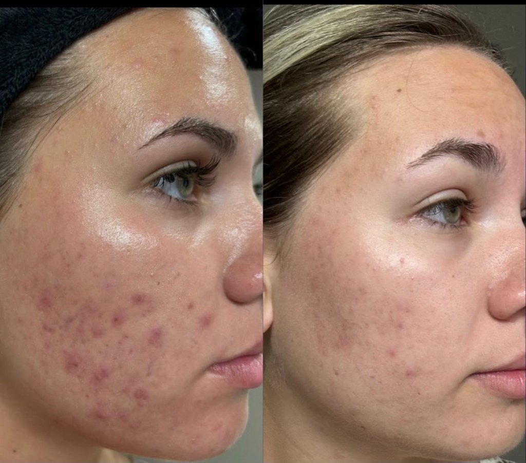 Before and after result 9