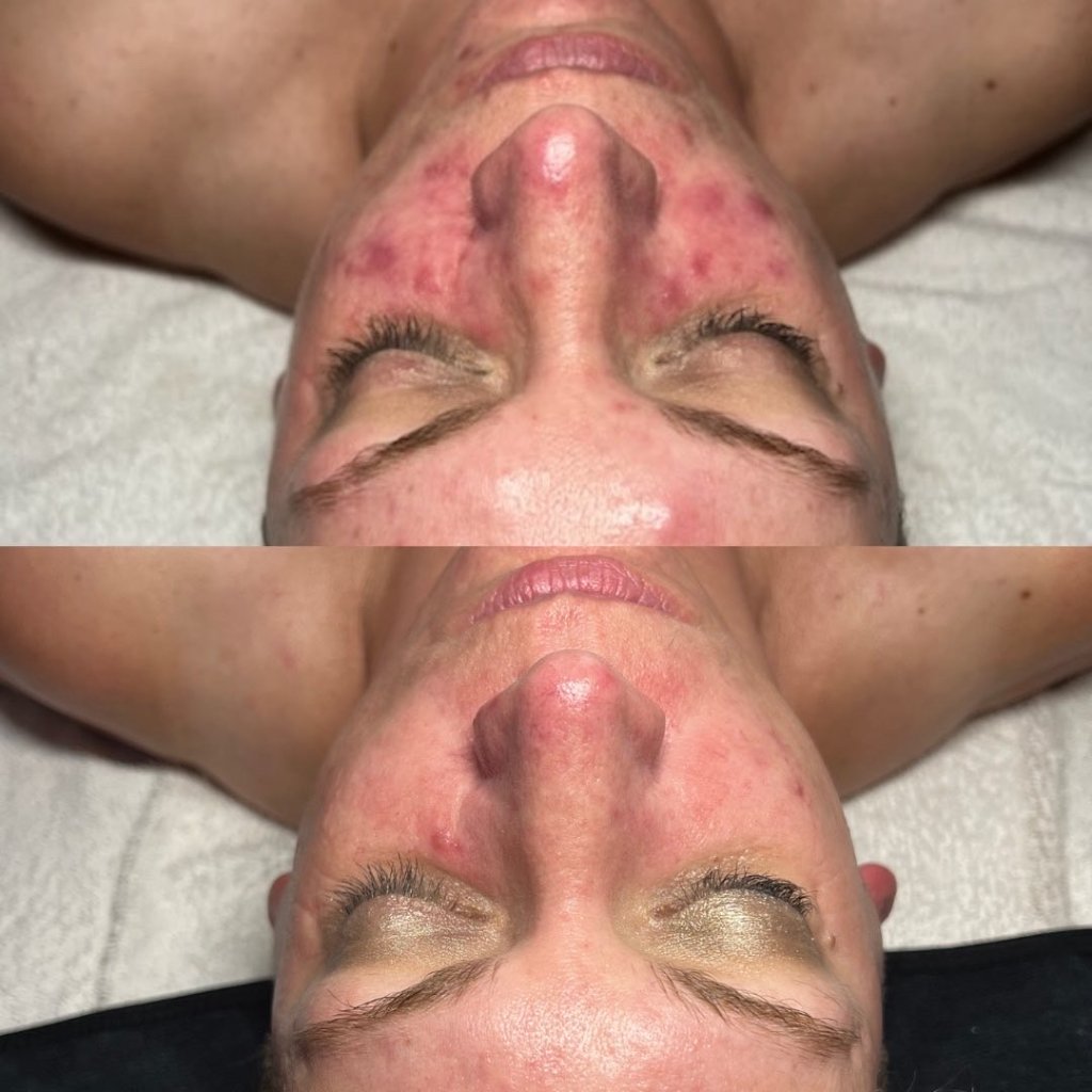 Before and after result 8