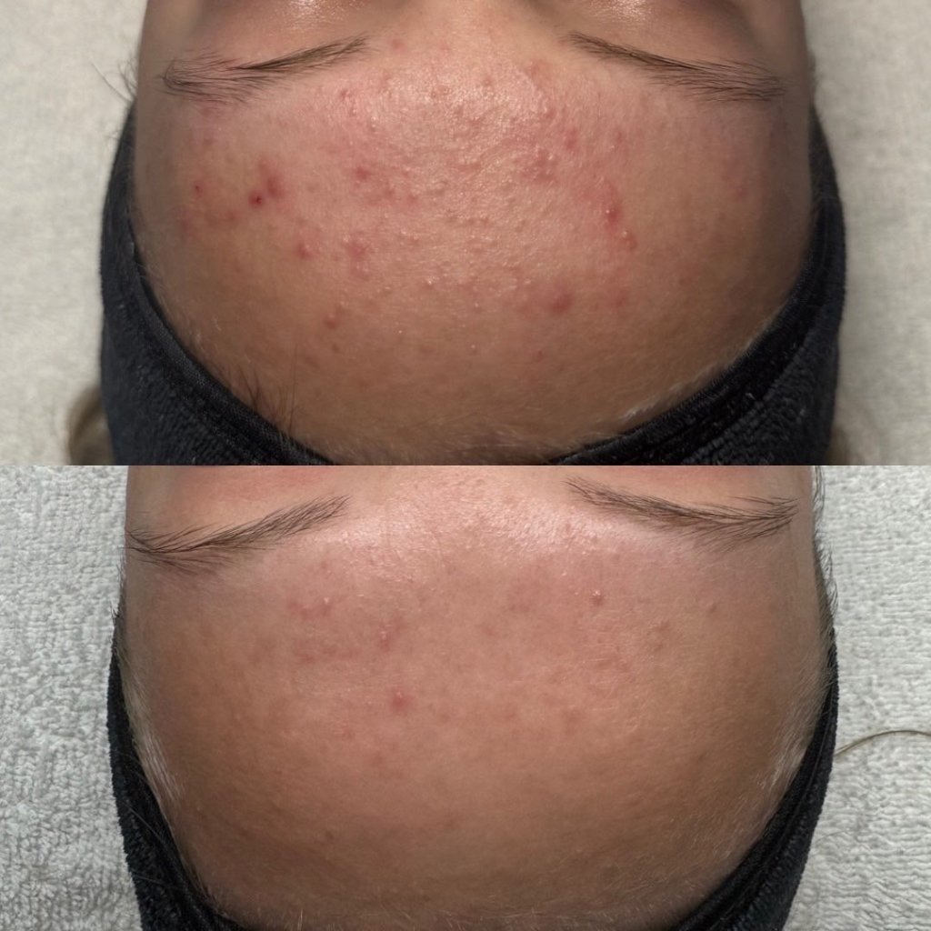 Before and after result 1