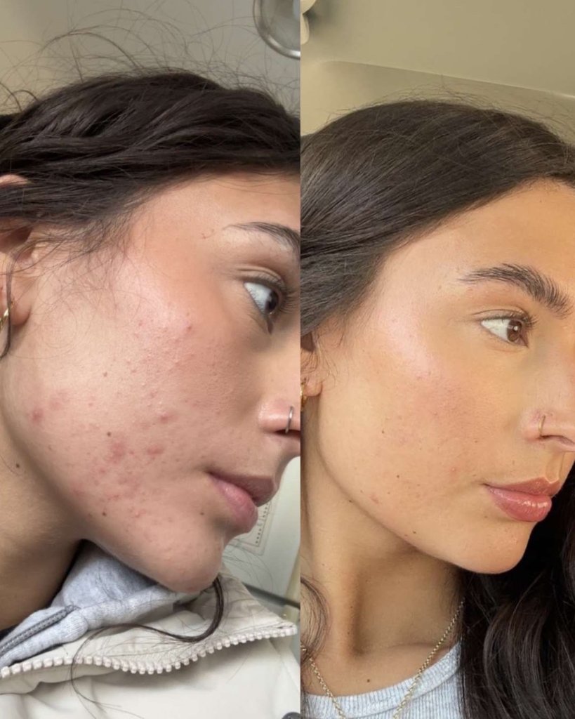 Before and after result 3
