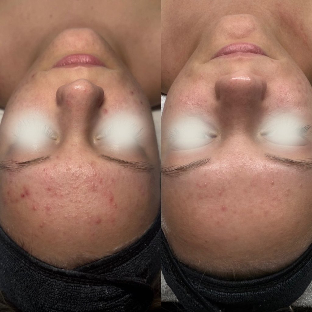 Before and after result 6