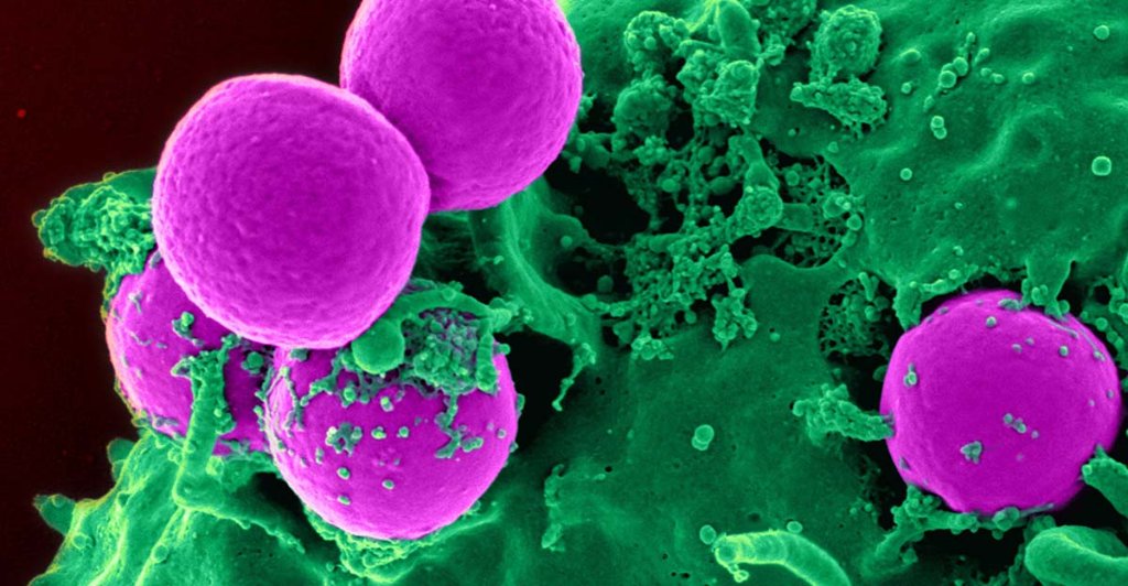 Características del cáncer: ayer, hoy y en el futuro
