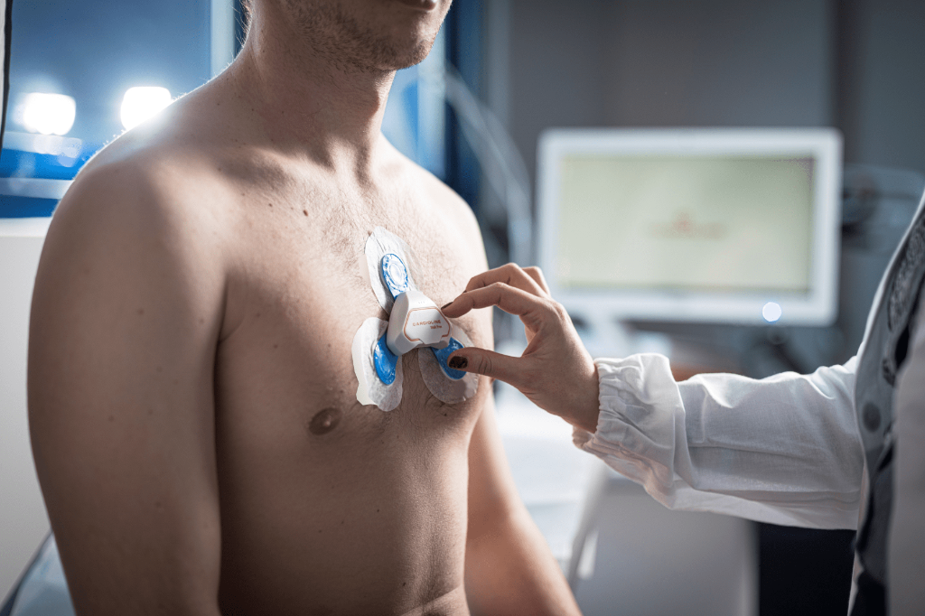 Holter Ρυθμού Βόλος - Cardioline Walkfree, 24ωρη καταγραφή αρρυθμιών, καρδιολόγος Μπουκής