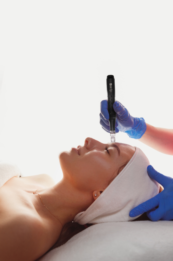 Microneedling