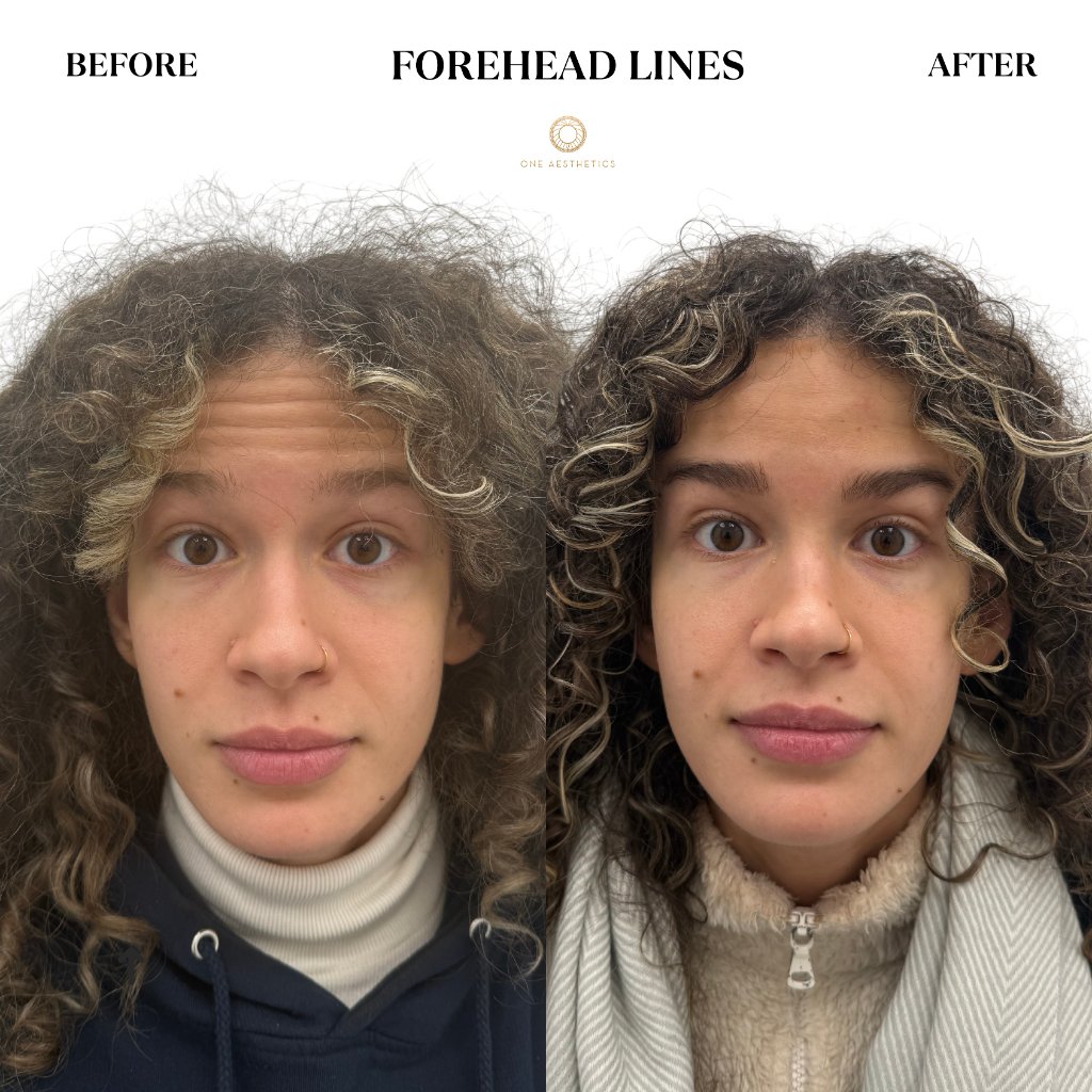Anti-Wrinkle