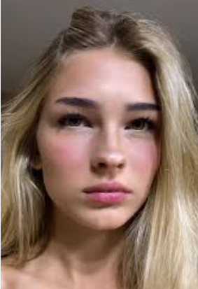 Skablatt