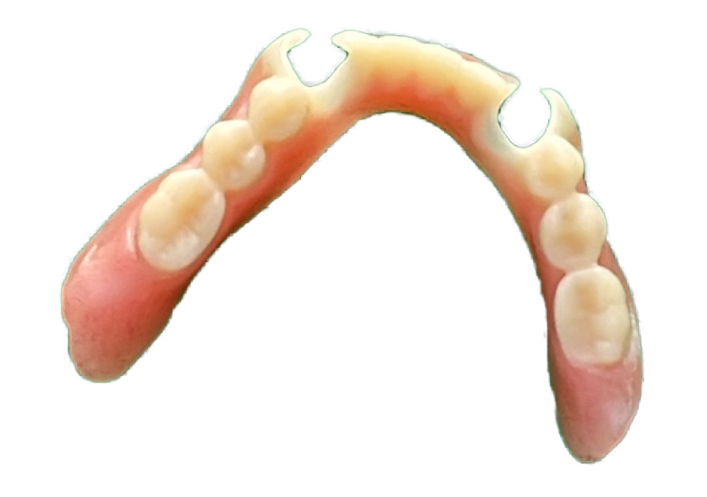 Lower flexible partial denture
