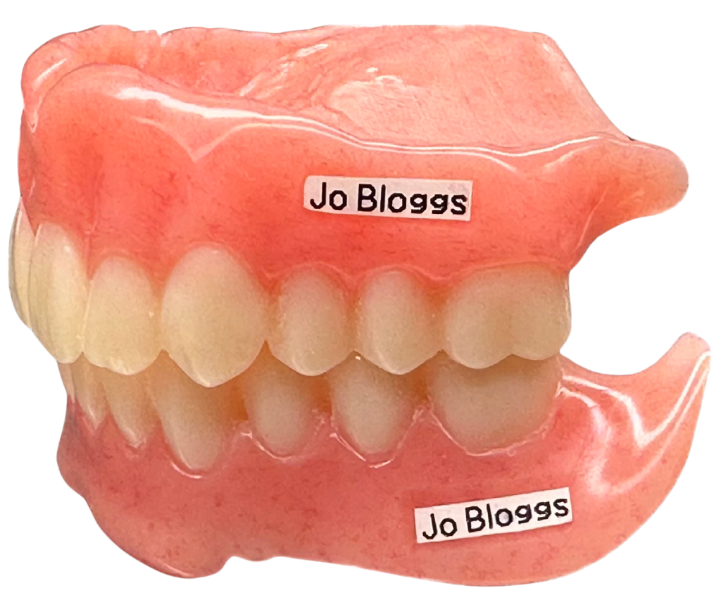 Dentures with patient name label embedded in the acrylic base
