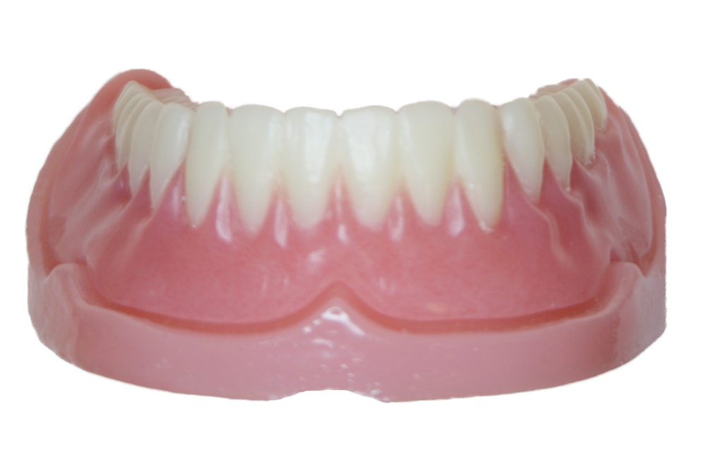Full lower immediate denture