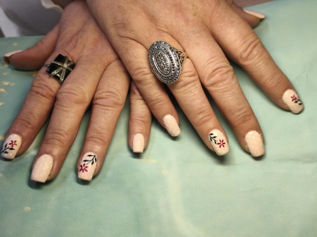 Reconstruction ongles orteils avant après - Lovadia