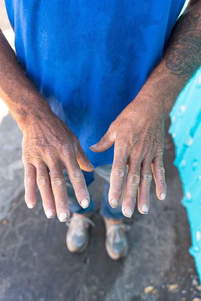 Weathered hands of a neighbor
